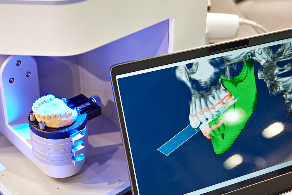 3d printed dental model - dental 3d printer - header